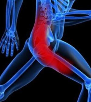 Combattere le infiammazioni del nervo sciatico con i rimedi naturali